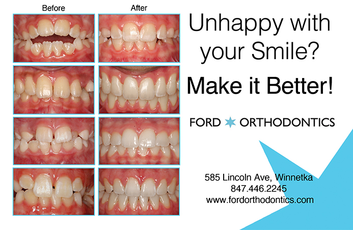 sponsored-Ford-Orthodontics