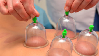 Cupping: What You Need to Know About This Treatment Used By Olympians