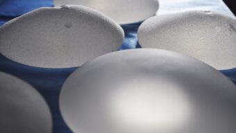 breast implants