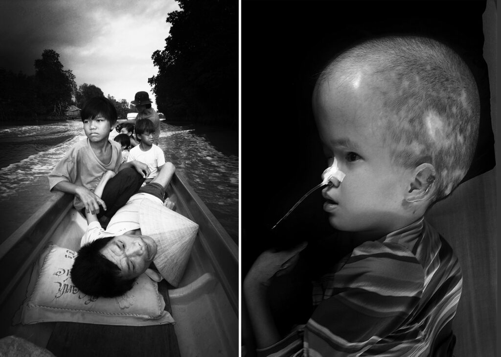 Nguyen Van Hung in 2006 (left) and Agent Orange victim (right).